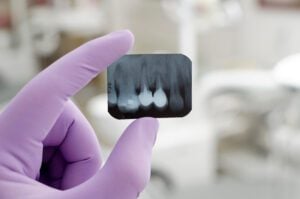digital X-rays dentist office