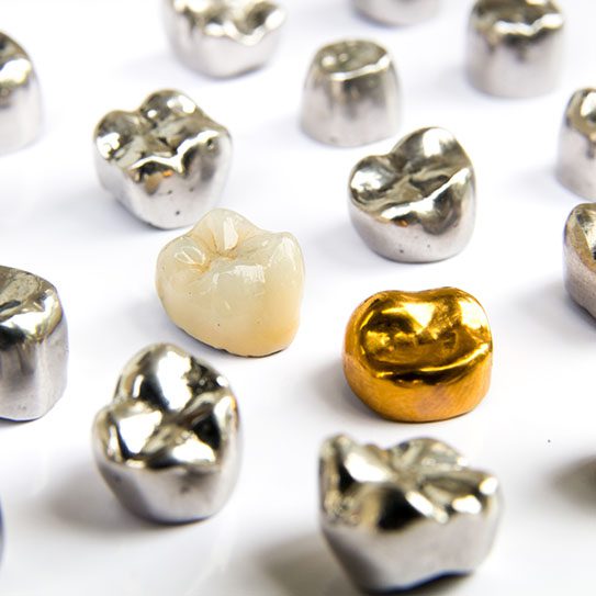 dental crown